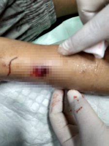 Polisi Selidiki Kasus Penembakan Di Tamansari Jakarta Barat