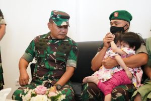 Haru Serda Fredrik Putri Kembar Siamnya Dijenguk Langsung Oleh Kasad