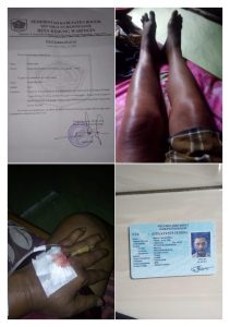 Klarifikasi Terkait ” Mobil Siaga Desa Digunakan Plesiran “