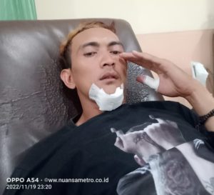 Saat di Acara Pernikahan, Wartawan Dikeroyok Orang Tidak Dikenal