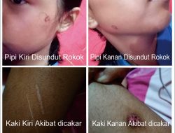 Ayah Kandung Ditangkap Karena Aniaya Anak Kandung Dibawah Umur Dengan Rokok