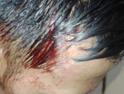 Korban Penganiayaan Yang Dilakukan FS Ternyata Adik Ketum FWJ Indonesia