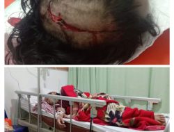 Ngeriii..!! Seorang Wanita Diduga Dianiaya Hingga Batok Kepala Retak dan Pendarahan Pada Otak