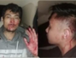2 Orang Pengurus FWJ Indonesia Korwil Kuningan Dikeroyok 15 Orang Ngaku Ormas Al Jabar